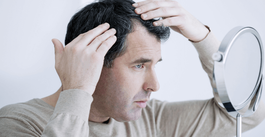 7 Questions to Ask Before Hair Transplantation